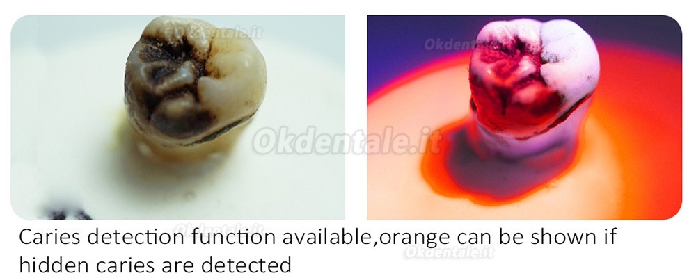 Lampada polimerizzatrice a LED dentale Mecco Q8 Pro con esposimetro integrato e rilevatore di carie
